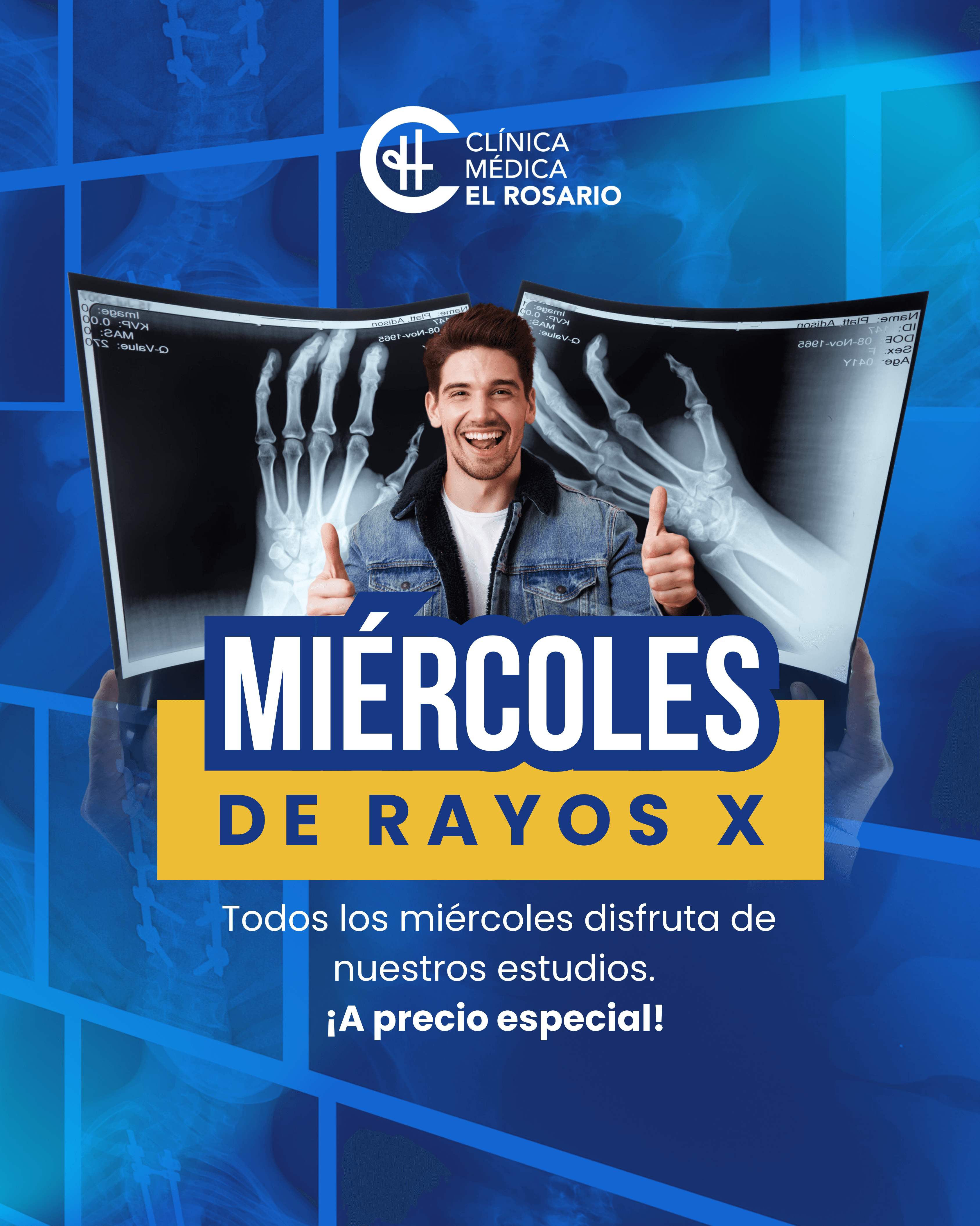 Rayos X